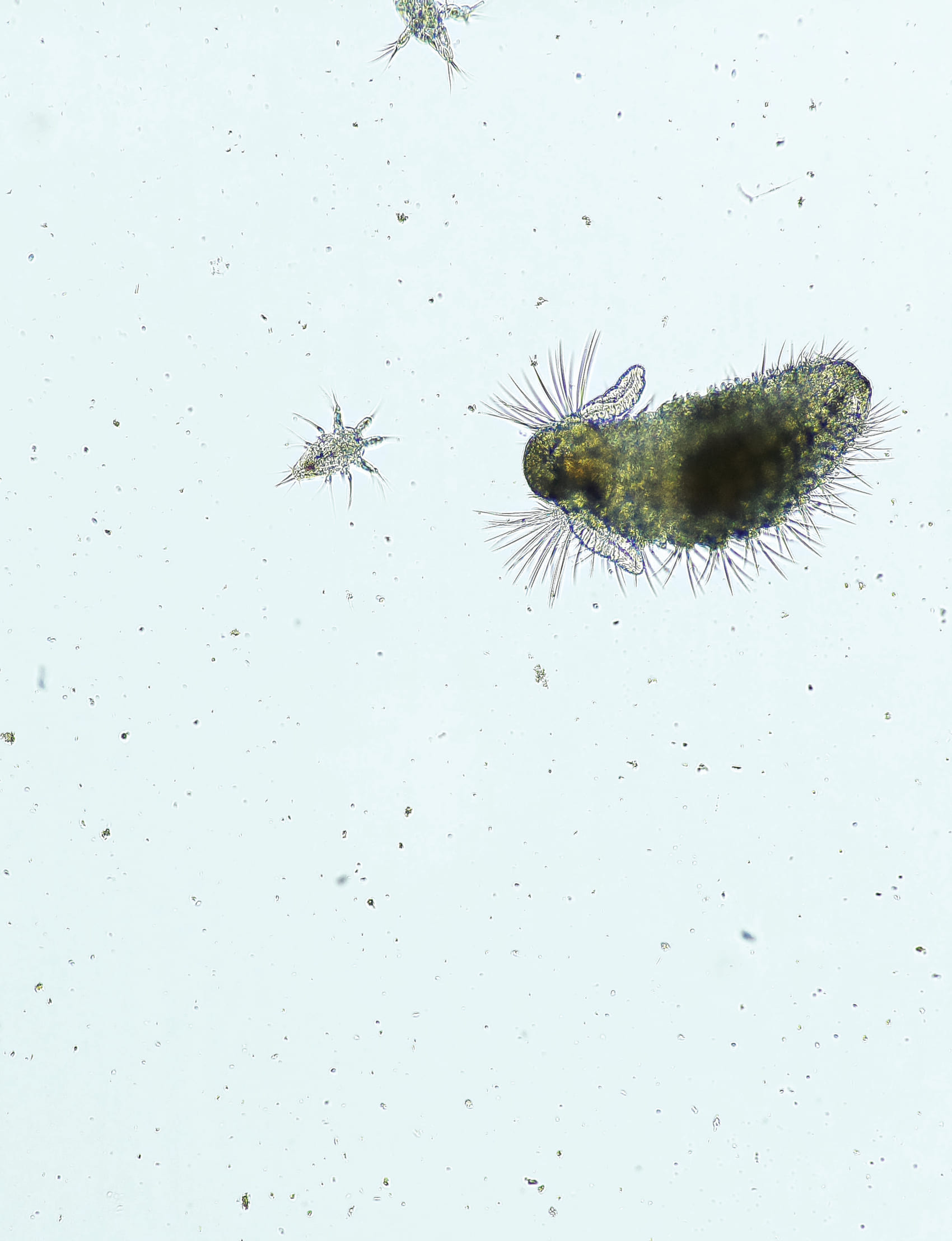 Plankton captured by the PlanktoScope.
